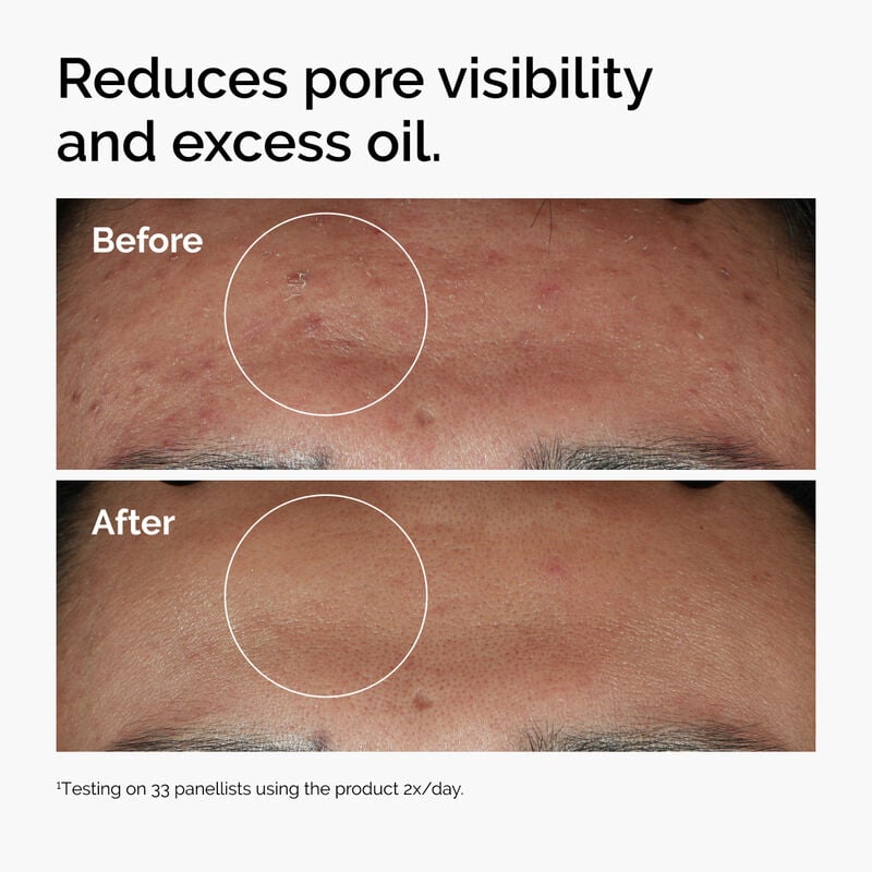 The Ordinary Niacinamide 10% + Zinc 1 % (30ML